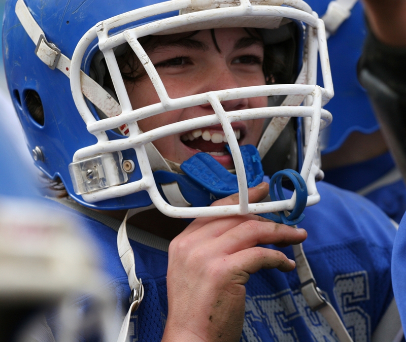 Wearing a mouth guard is important to protect against dental trauma.