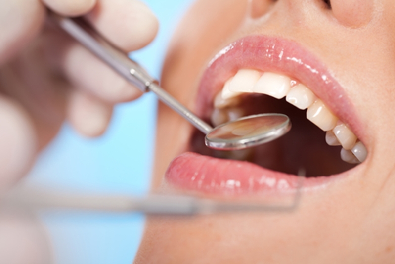 Women mouth and teeth at dentist office.