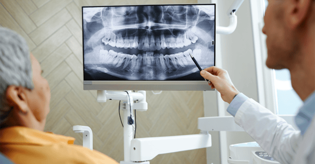 Root canal