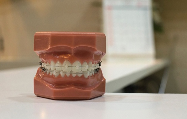 Adult tooth replica with braces attached