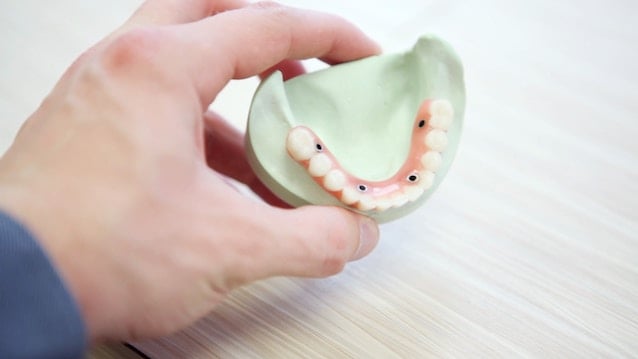 teeth-model-impression