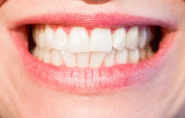 teeth-mouth-smile.jpg